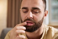 herpes-buccal-traitement