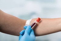 taux-de-creatinine-elevee