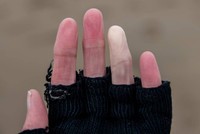 gants-chauffants-maladie-de-raynaud
