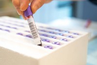 cholesterol-total-au-dessus-de-la-norme