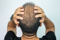 5-perte-de-cheveux-et-changements-dans-la-peau