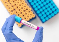 triglycerides-c-est-quoi