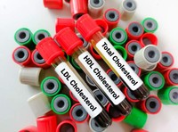 cholesterol-total-calcul