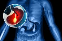 ballon-gastrique-prix-le-moins-cher