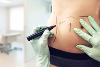 liposuccion-ventre-ratee