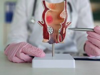 traitement-hemorroide-efficace-sans-ordonnance