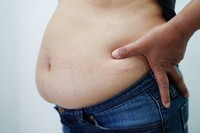 frais-a-prevoir-sleeve-gastroplastie