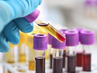 polype-vessie-est-ce-grave