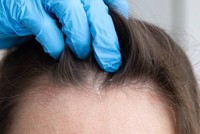 cuir-chevelu-qui-gratte-causes-facteur-de-risque