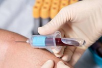 creatinine-elevee-symptomes