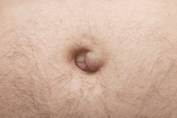 hernie-ombilicale-adulte