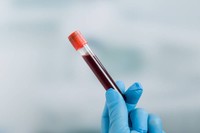 quel-taux-de-cholesterol-ldl-pour-une-femme-de-70-ans