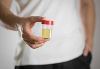 creatinine-urinaire-haute-cause